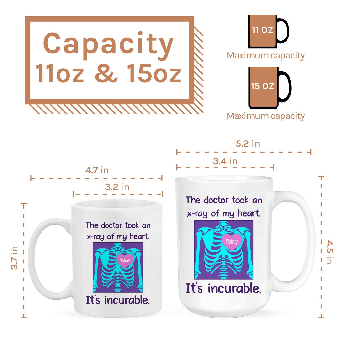 It's Incurable - Personalized Anniversary, Valentine's Day, Birthday or Christmas gift For Him or Her - Custom Mug - MyMindfulGifts